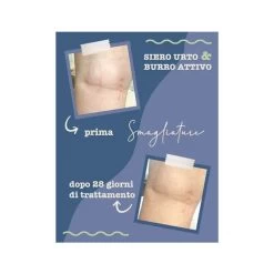 La Saponaria Siero Urto Smagliature 100ml -Negozio Di Prodotti Per La Cura doccia shampoo barca mare camp 984520027 1 4 1668417434